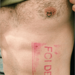 Homem com a blusa levantada e, em sua costela, há um carimbo vermelho escrito "Foi Deus"