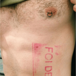 Homem com a blusa levantada e, em sua costela, há um carimbo vermelho escrito "Foi Deus"